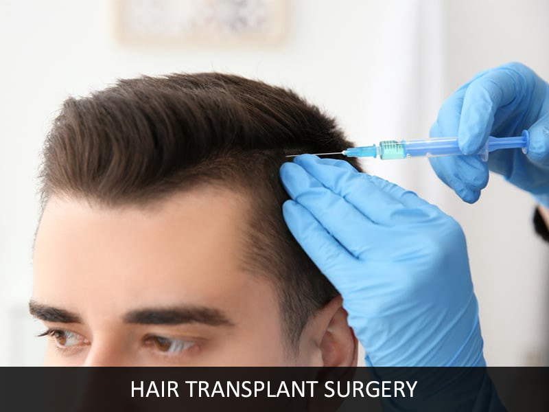 Beard Hair Transplant